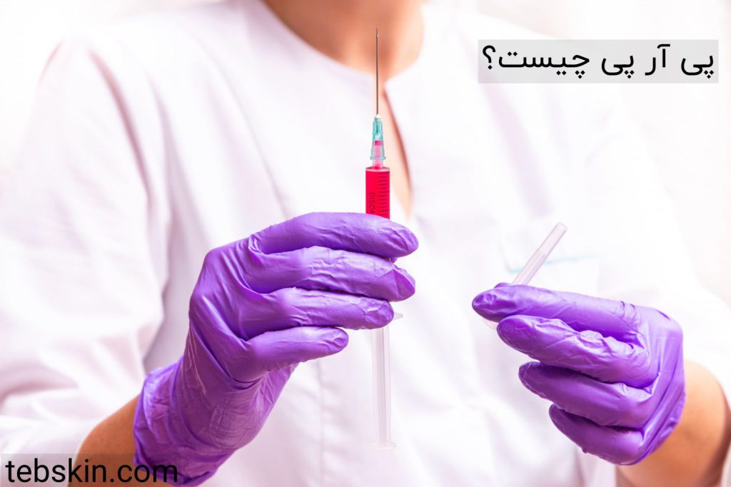 پی آر پی چیست