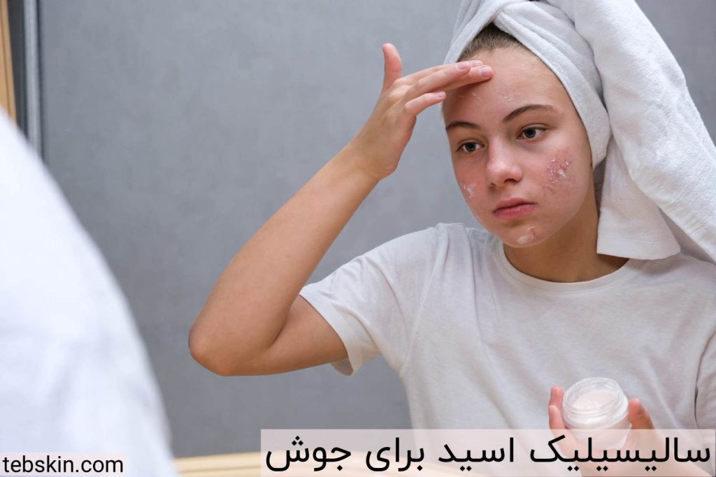سالیسیلیک اسید برای جوش