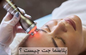 پلاسما جت چیست