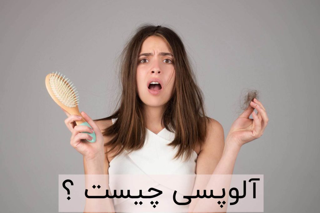 آلوپسی چیست