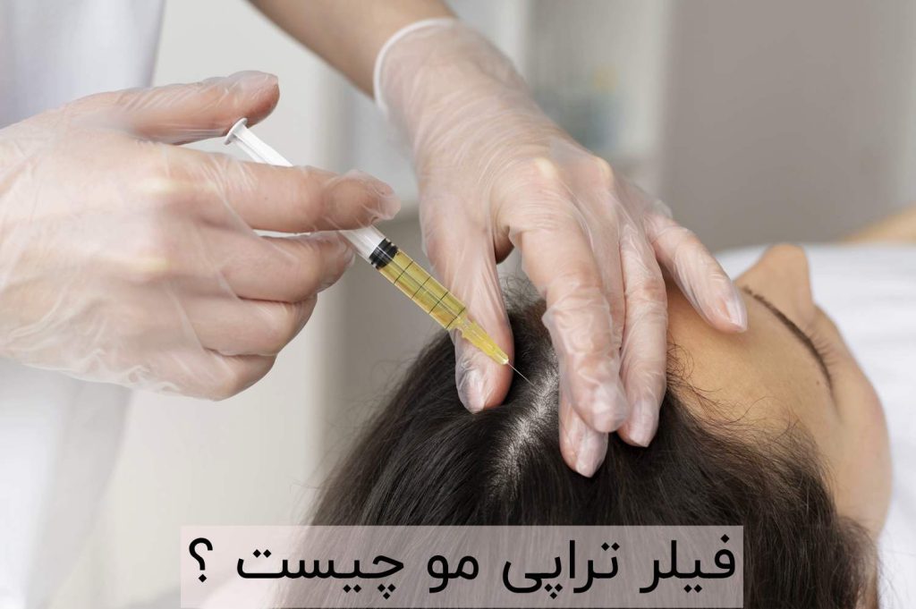 فیلر تراپی مو چیست