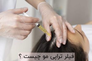 فیلر تراپی مو چیست