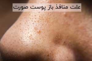 علت متافذ باز پوست