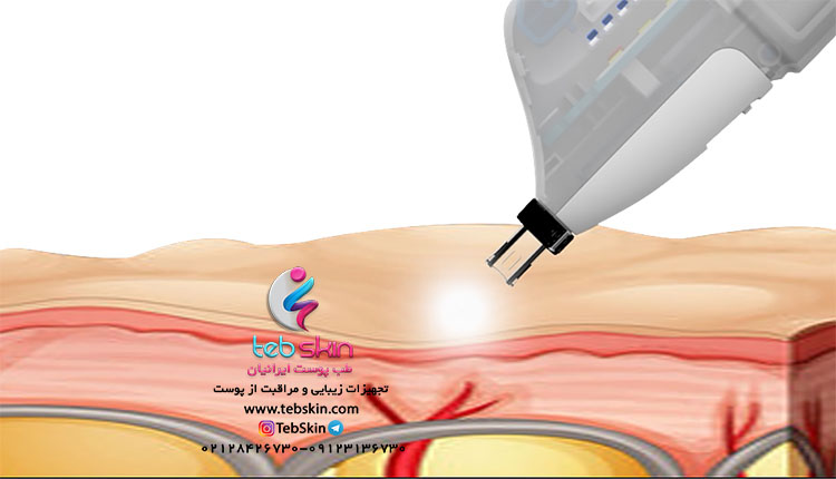 دستگاه تزریق prp مدل 2020 WEISHU - تصویر 5